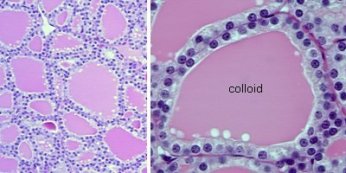 Figura 1: Follicoli (unità morfologica e funzionale)